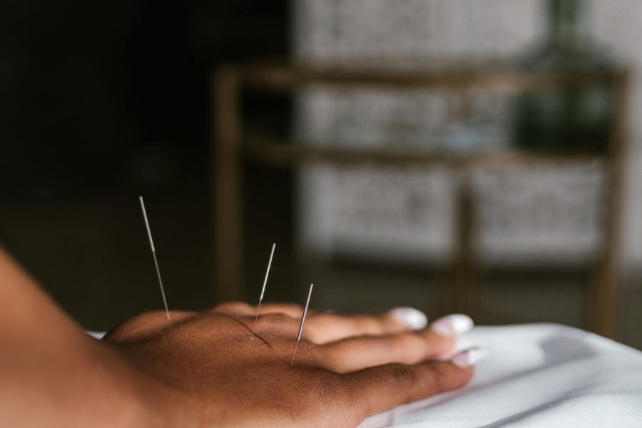 Basic Acupunture (Cupping & infrared)